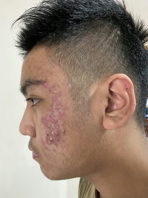 ¿Cómo reconocer y tratar una infección respiratoria en aves pequeñas?